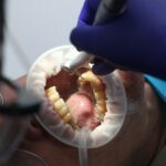 diegotoralabad-dentist-7397737 (1)